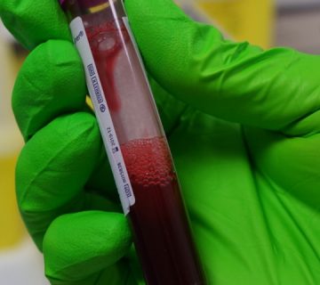Biobank Côte d'Azur